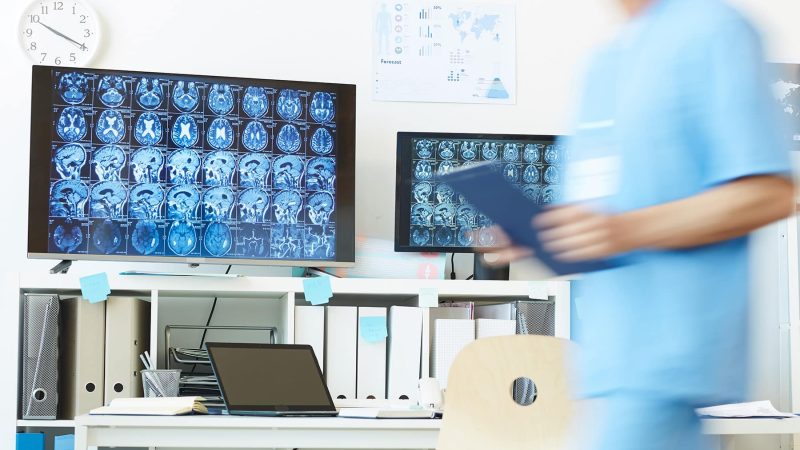 Idrocefalo normoteso: diagnosi neurospicologica e trattamento neurochirurgico
